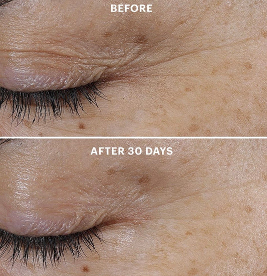 Bio-Renew EGF Eye Cream