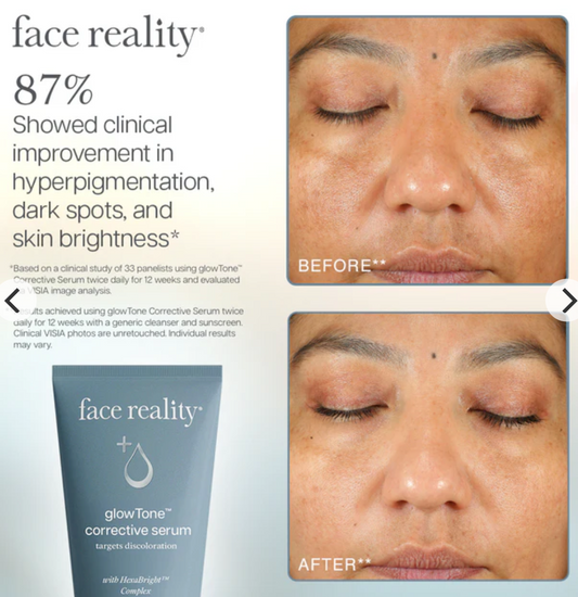 GlowTone Corrective Serum