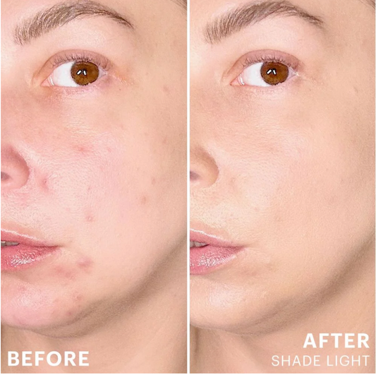 Spot Treat Concealer