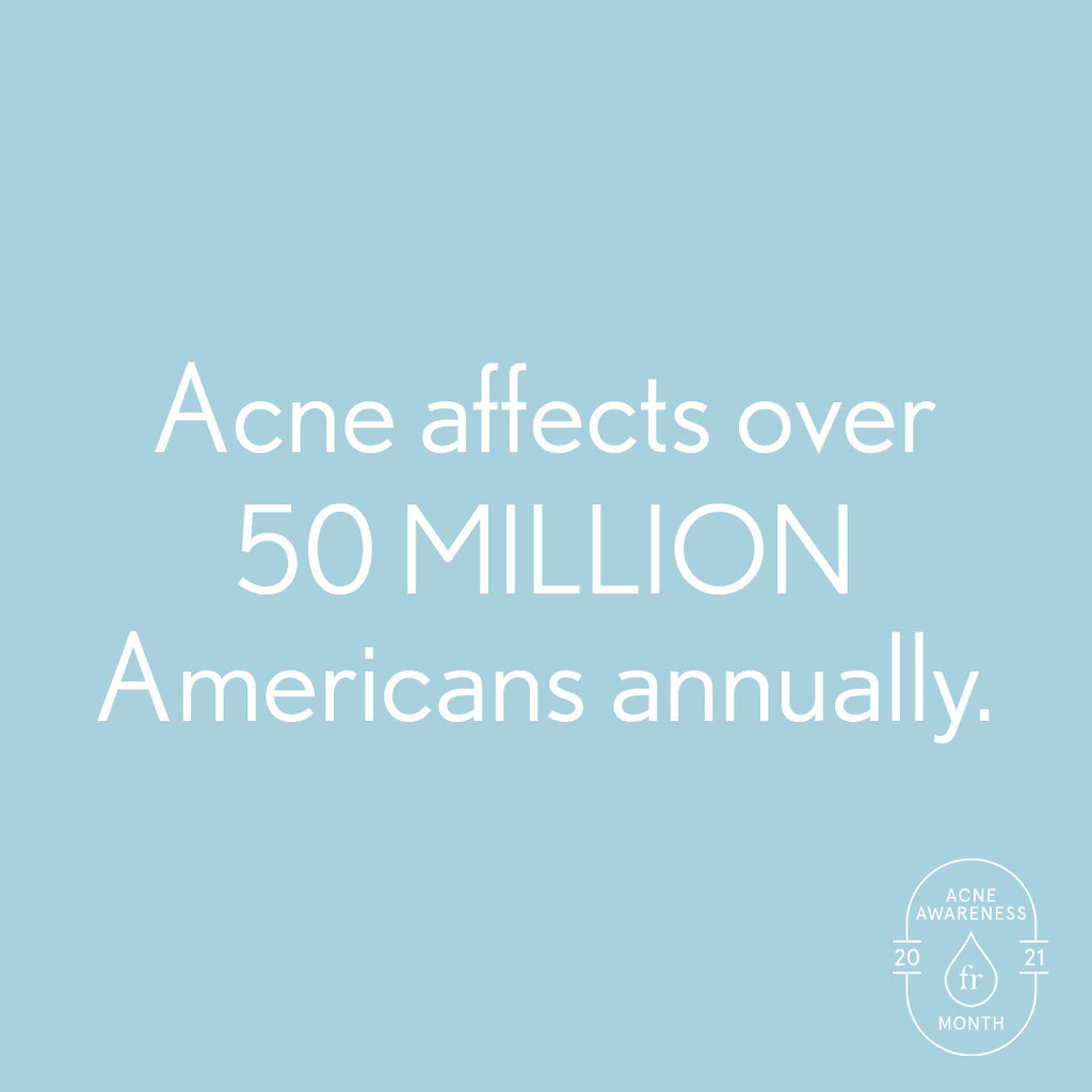 Must Haves for Acne Breakouts