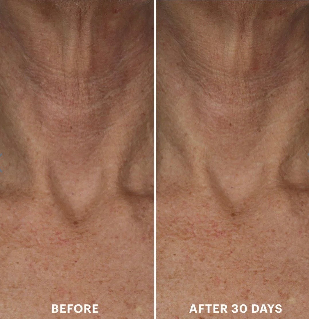 Bio-Renew EGF Neck Cream