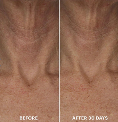 Bio-Renew EGF Neck Cream