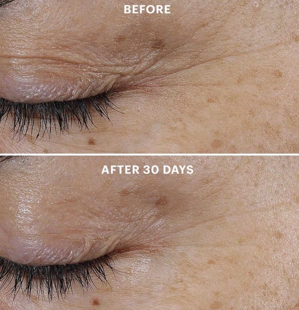 Bio-Renew EGF Eye Cream