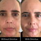 Omnilux Contour Face