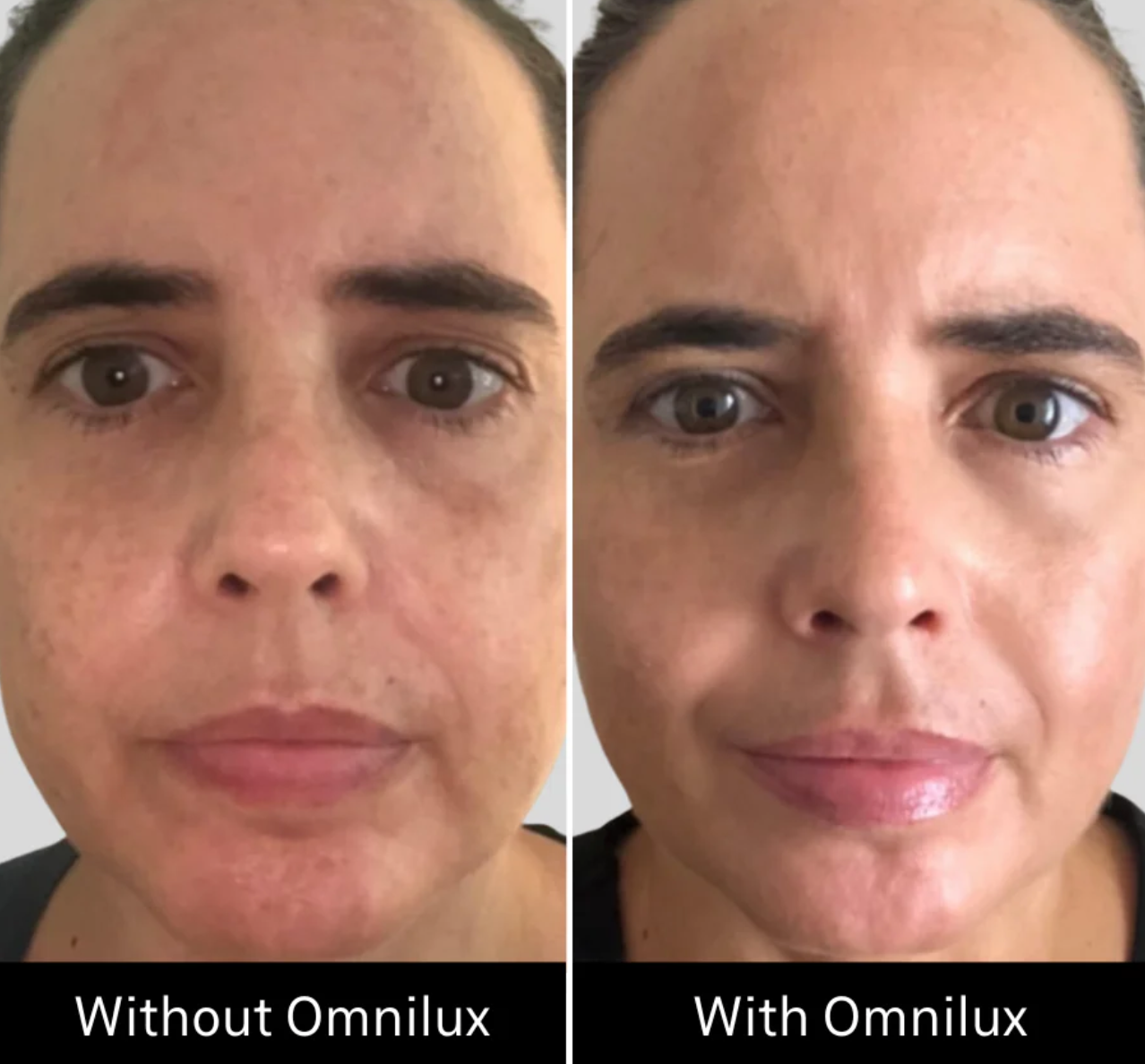 Omnilux Contour Face