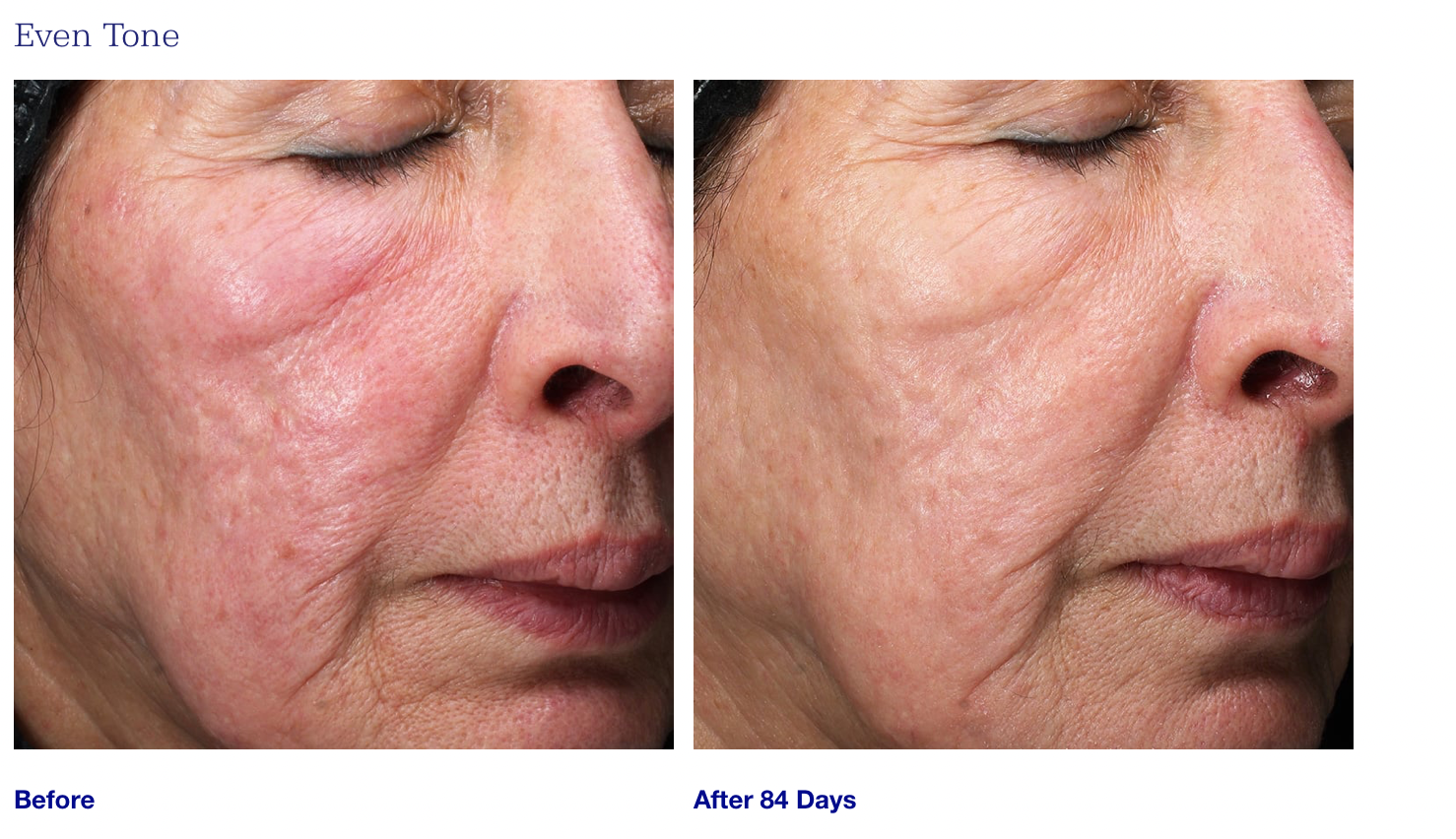 Retinol+ Emulsion 0.3