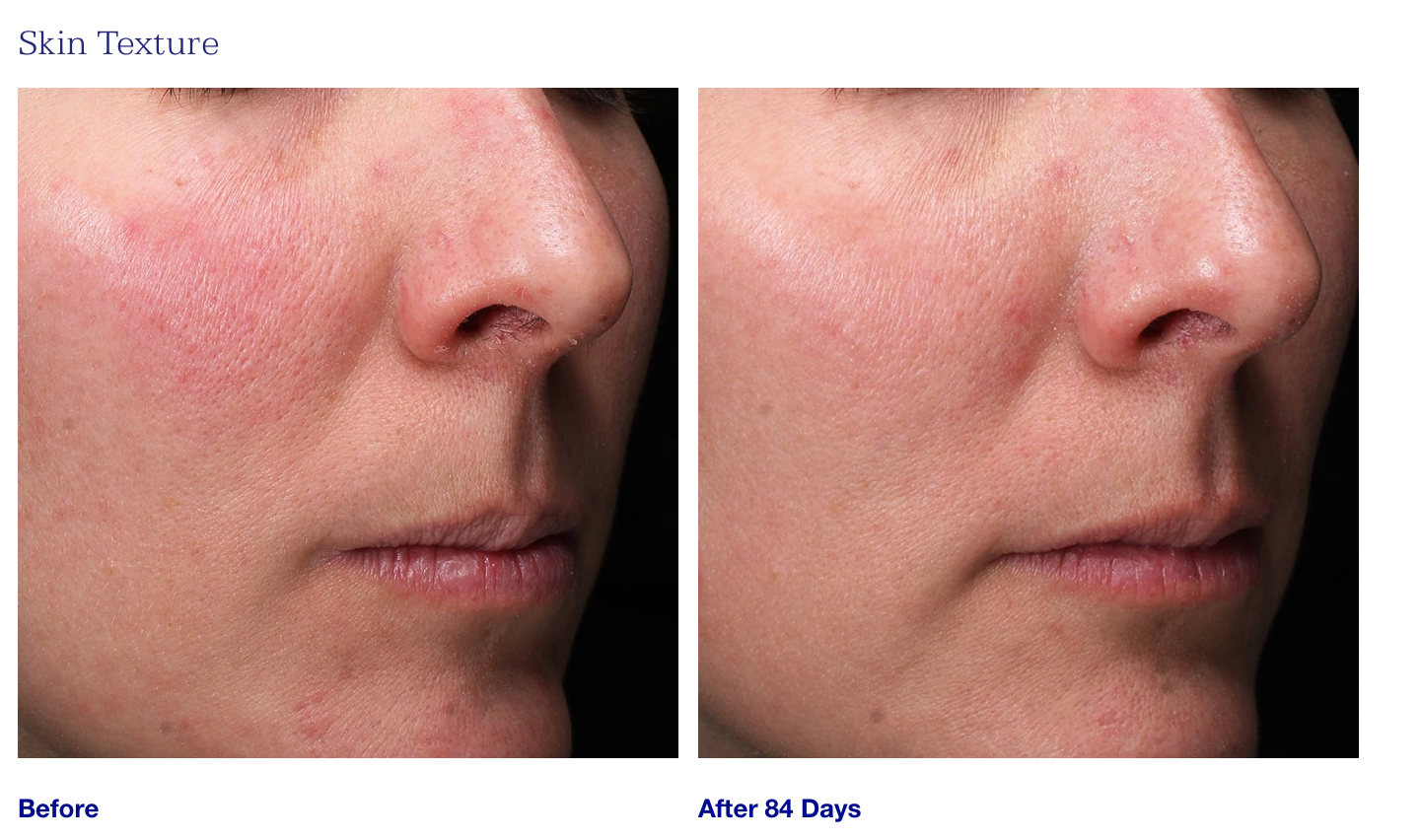 Retinol+ Emulsion 0.3