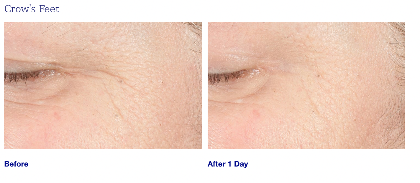 Youth Intensive Cream 1.7 oz