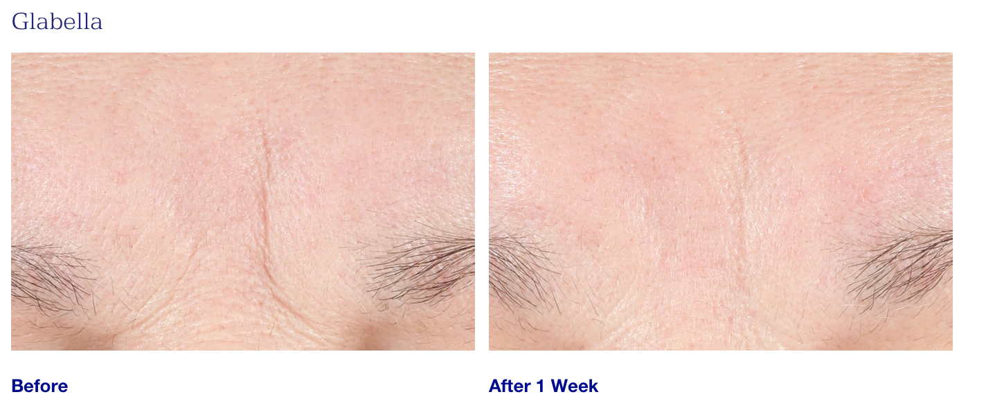 Youth Intensive Cream 1.7 oz