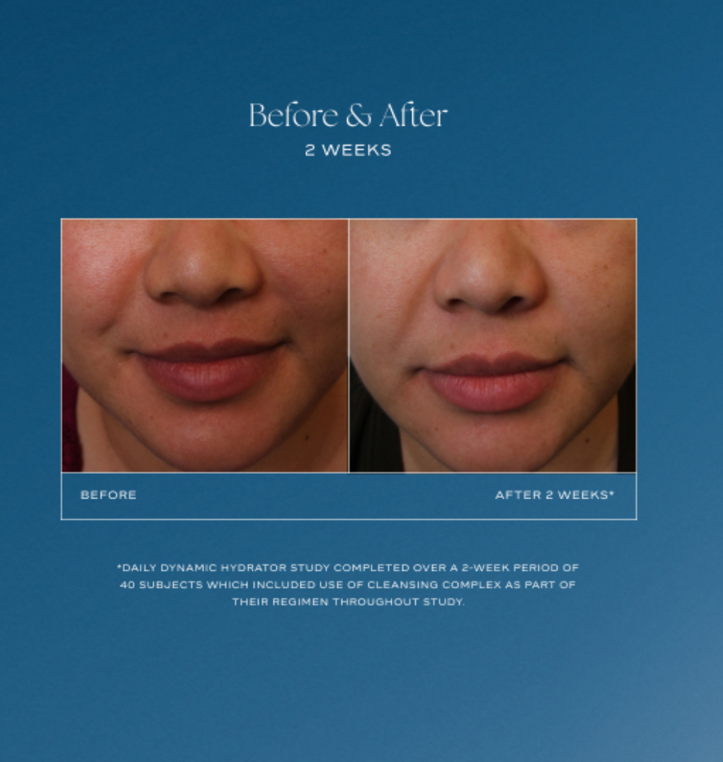 Before and after results using iS Clinical Daily Dynamic Hydrator 3-in-1 moisturizer with vitamin C and peptides to brighten, smooth texture, and hydrate skin at The Skyn Distillery Wayzata Minnesota