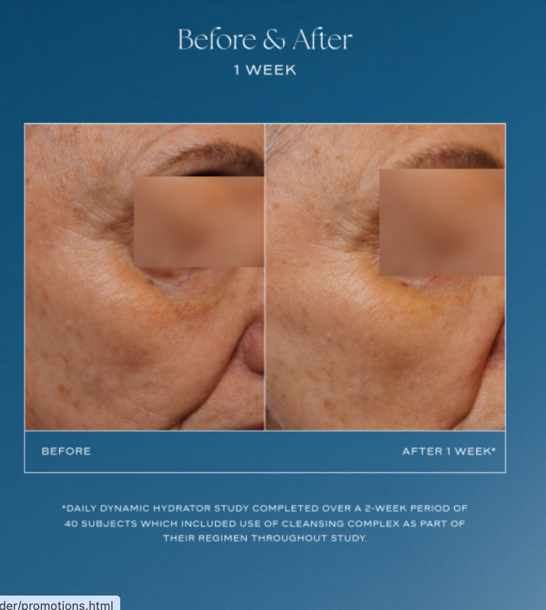 Before and after showing hydration, glow, and improved fine lines with iS Clinical Daily Dynamic Hydrator 3-in-1 vitamin C peptide moisturizer at The Skyn Distillery in Wayzata MN